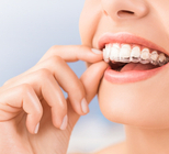  יישור שיניים עם פלטות שקופות: ללכת עם, להרגיש בלי-תמונה